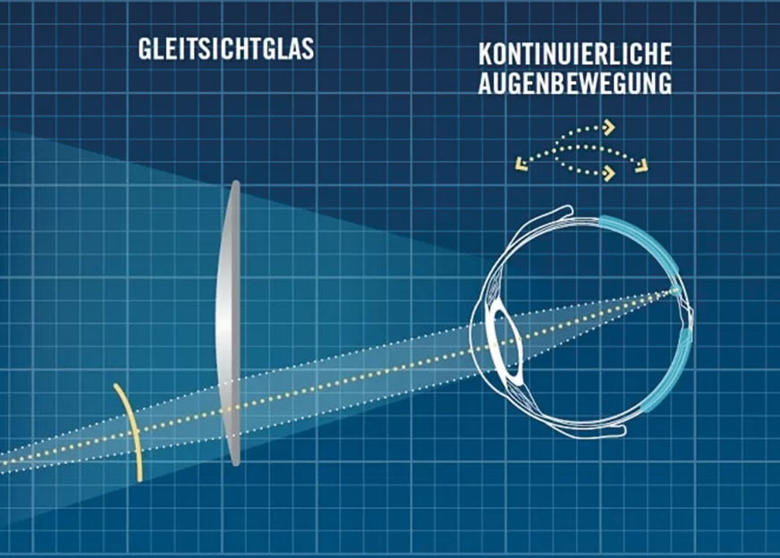 B.I.G. EXTRACT eye movement Chalon AG Laufen B.I.G. EXTRACT eye movement Chalon AG Laufen